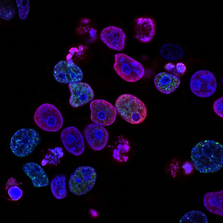 Cancer Trust image of Cells